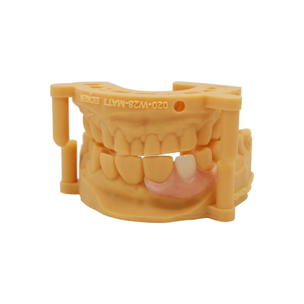 Adding Teeth to Valplast Partials Denture