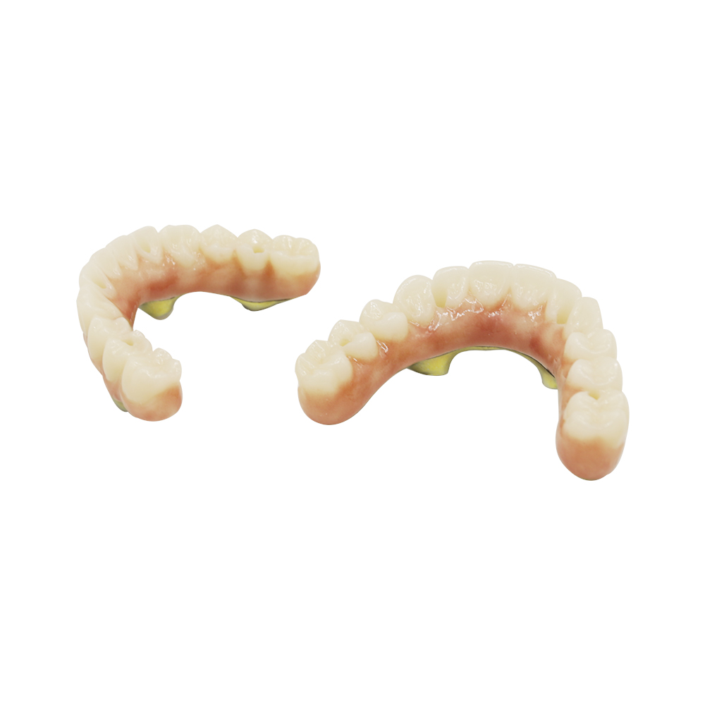 All On 4 Dental Implants - case 2