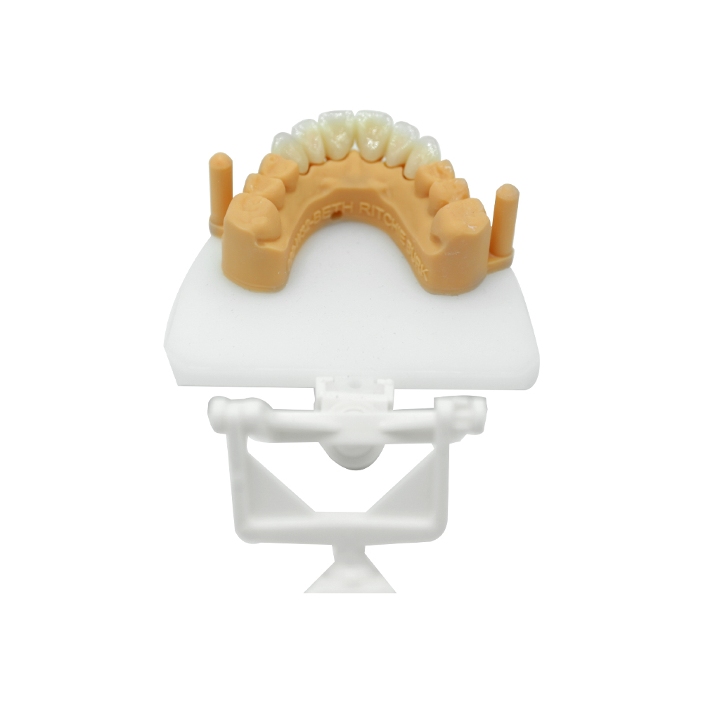 Anterior Zirconia Crown And Bridge