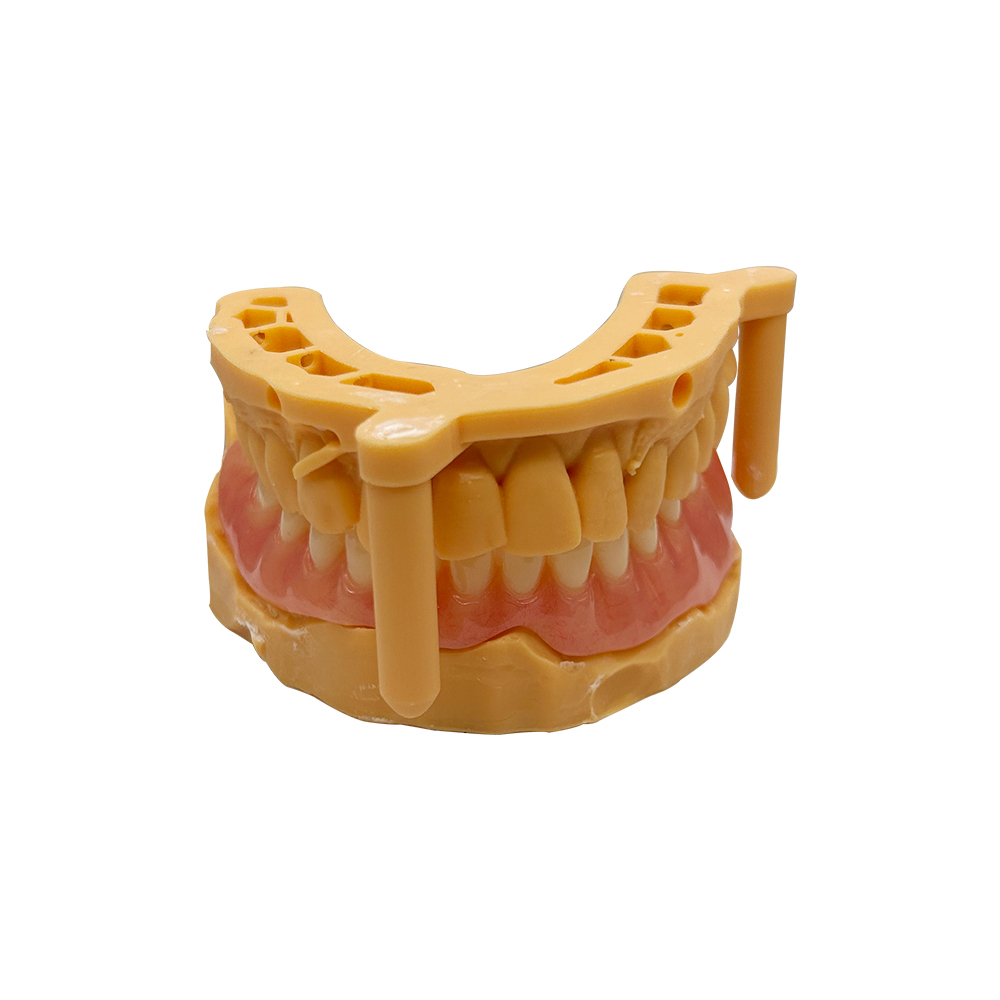 Complete Upper Mandibular Denture - case 2