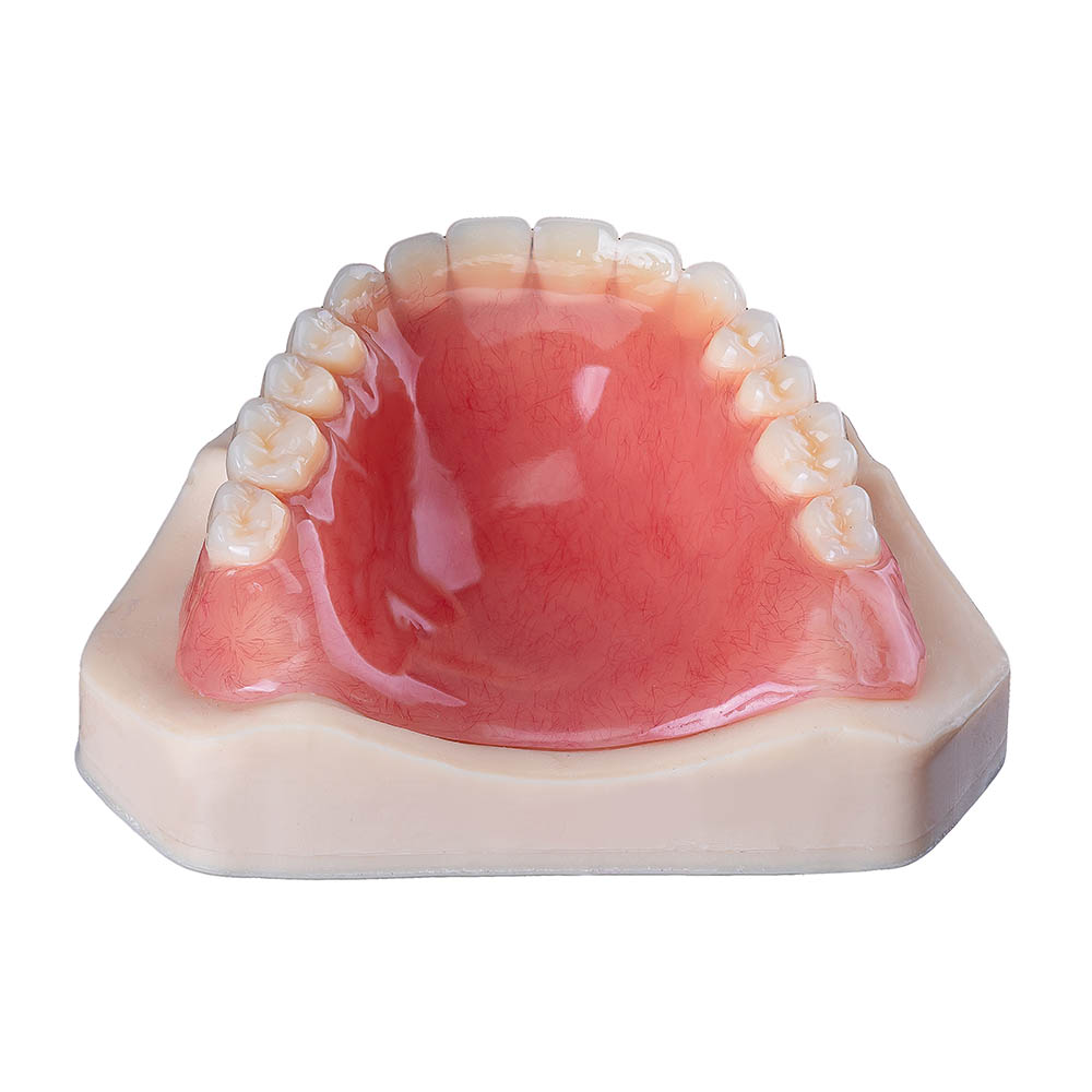 Complete Upper Mandibular Denture - case 3