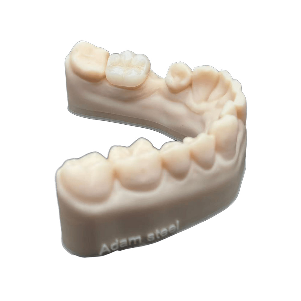 Emax Dental Crowns - case 2