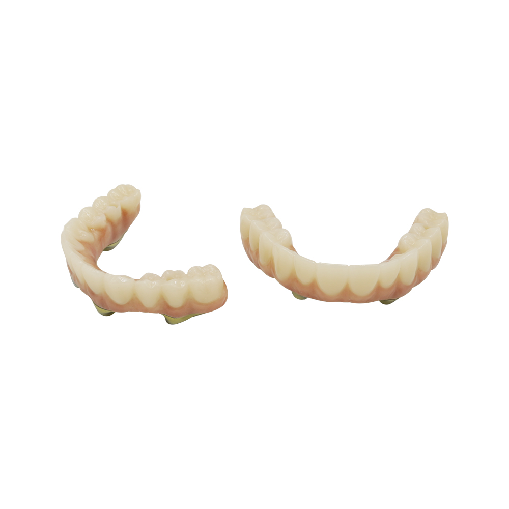 Implant Supported Dental Bridge