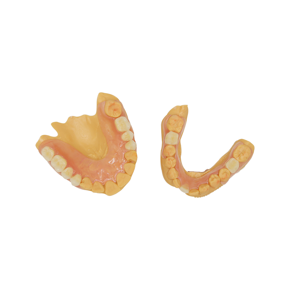 Palateless Dentures