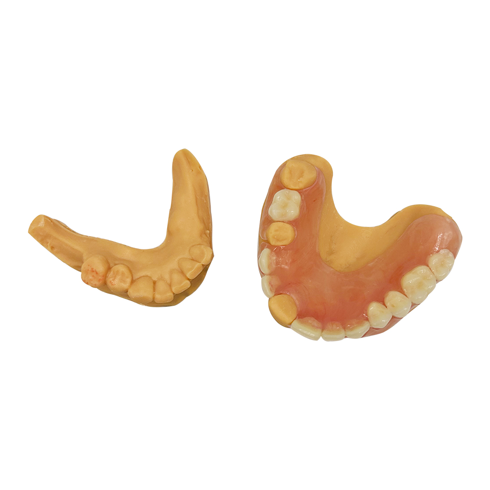 Temporary Immediate Dentures - case 2